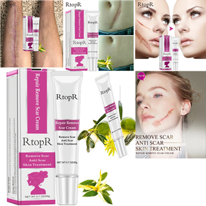 rtopr repair remove scar cream
