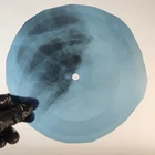 BEATLES LET IT BE X-Ray USSR Record Roentgen Bone Ribs Music Vinyl