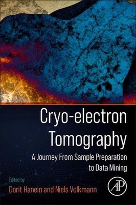 Cryo-electron Tomography: A Journey From Sample Preparation to Data Mining by Do
