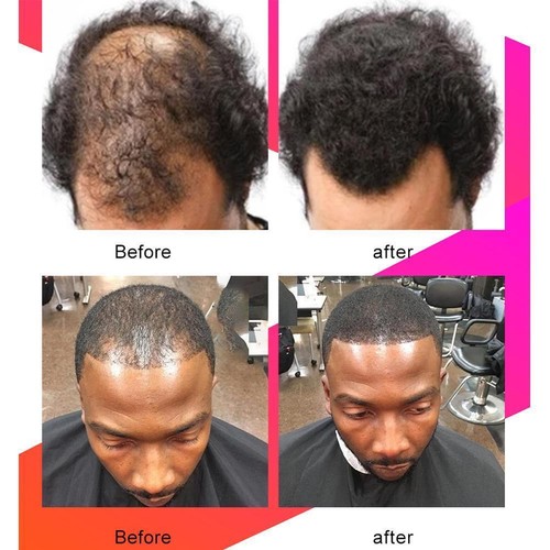 Chebe Powder Africa Frauen Traktion Alopecia-Behandlung Männer Öl Haare NEU Q5🌿 - Picture 9 of 12