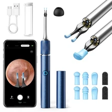 Qimic Ear Camera with Tweezers - Ear Cleaner with Camera,1080P HD Earwax Remo...