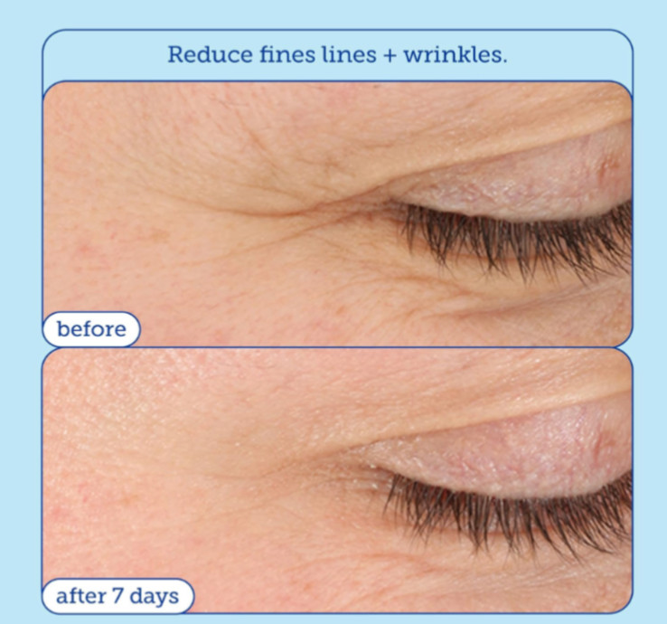 Skinfix Barrier + Lipid-Boost 360° Eye Cream 0.5 fl oz New in Box