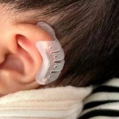 Ear Orthopaedic Patch Protruding Ear Corrector Baby Ear Support Patches