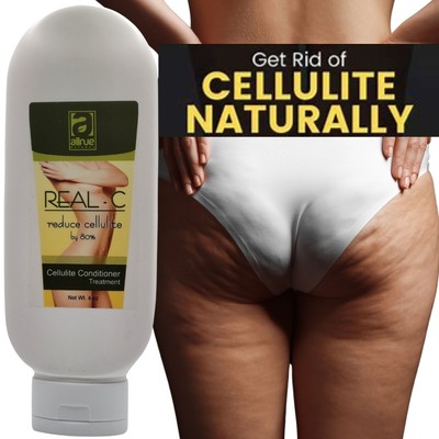 Body Reshaping Creams for Cellulite Reduction and Anti-Stretch Marks/slimming .
