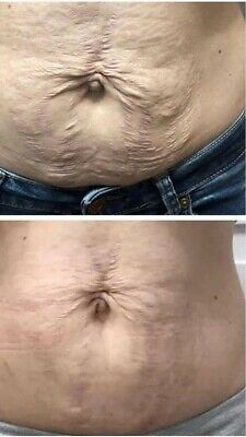 Nuskin BrandNew Well Spa iO Body Spa Iron Stretchmarks Nuskin BrandNew Well Spa iO Body Spa Iron Stretchmarks
