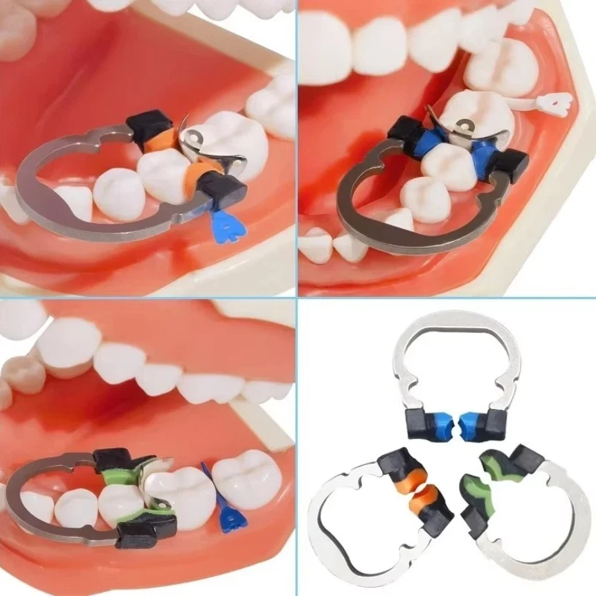 Dental Matrix Bands Ring Sectional Matrice Clamp Fit Garrison Palodent V3 System - Image 4 of 4