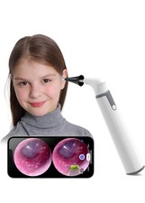 Wireless Otoscope Ear Camera with Dual View, 3.9Mm 720PHD Wifi Ear Scope 6 LED