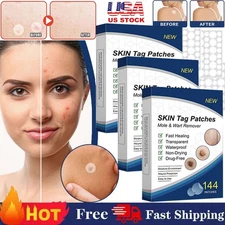 720PC Skin Tag Remover Patches Quick Effective Mole and Wart Pad Removal Sticker