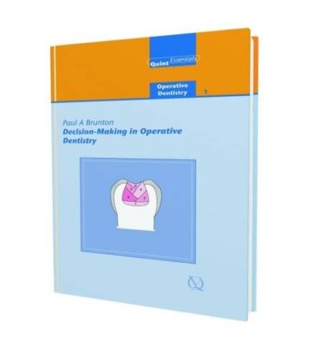 Decision-making in Operative Dentistry,Paul A. Brunton, Nairn H.