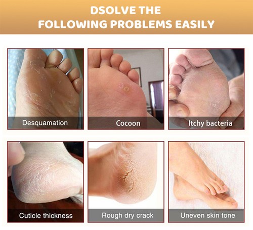 Aichun Repairing Foot Cream Avocado Snail Deep Moisturizing Dry Rough Skin 100ml - 第 4/11 張圖片