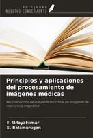 Principios Y Aplicaciones Del Procesamiento De ImáGenes MéDicas Taschenbuch 2024