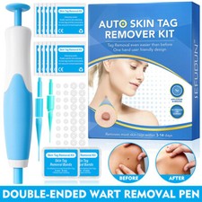 Auto Micro Skin Tag Remover Pen Device Kit Safe Painless Removal Skin Care Tool