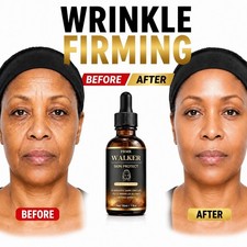 Walker Skin Protect Serum Black Women Gentle Facial Skin Care Moisturizing NEW