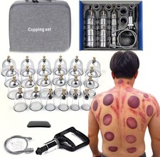 Cupping Relax Set Multiple Sizes of Vacuum Cups with Hand Pump