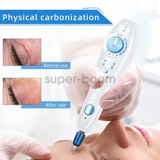 Fibroblast Plasma Device for Scar Reduction, Wrinkle  Stretch Mark Removal