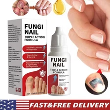 Fungi-Nail Anti-Fungal Liquid Solution Kills Fungus That Can Lead To Nail