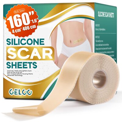 Professional Silicone Scar Sheets (Roll 1.6 * 160''- 4.06M) - Extended Edition...