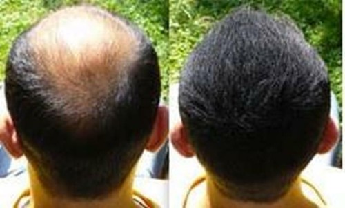 HAIR FUSION - 100% Real Human Hair Fibers - Conceal Assorted Sizes , Colors - Picture 63 of 73
