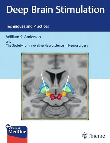 Deep Brain Stimulation – Techniques and Practices Anderson Hardback