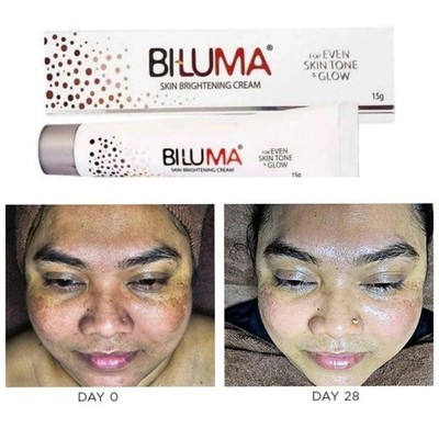 Biluma Skin Brightening Cream | For Even Skin Tone & Glow - 15gm x 2 pcs