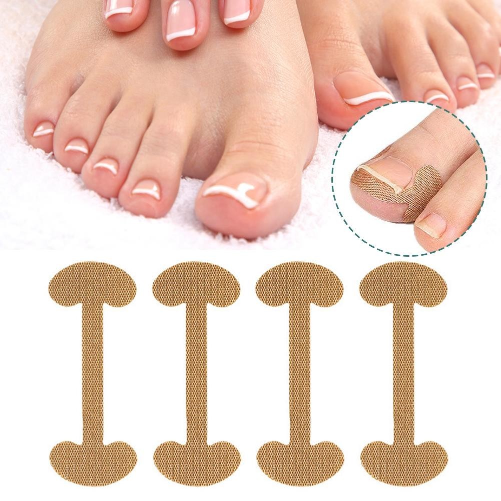 4x Toe Nail Straightener Ingrown Toenail Paronychia Correction-Patc h M4G7 thumbnail 7