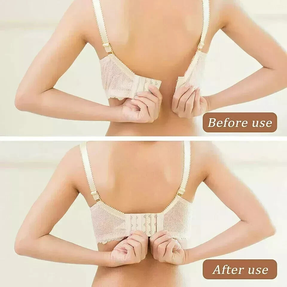 Foto 10 di 11