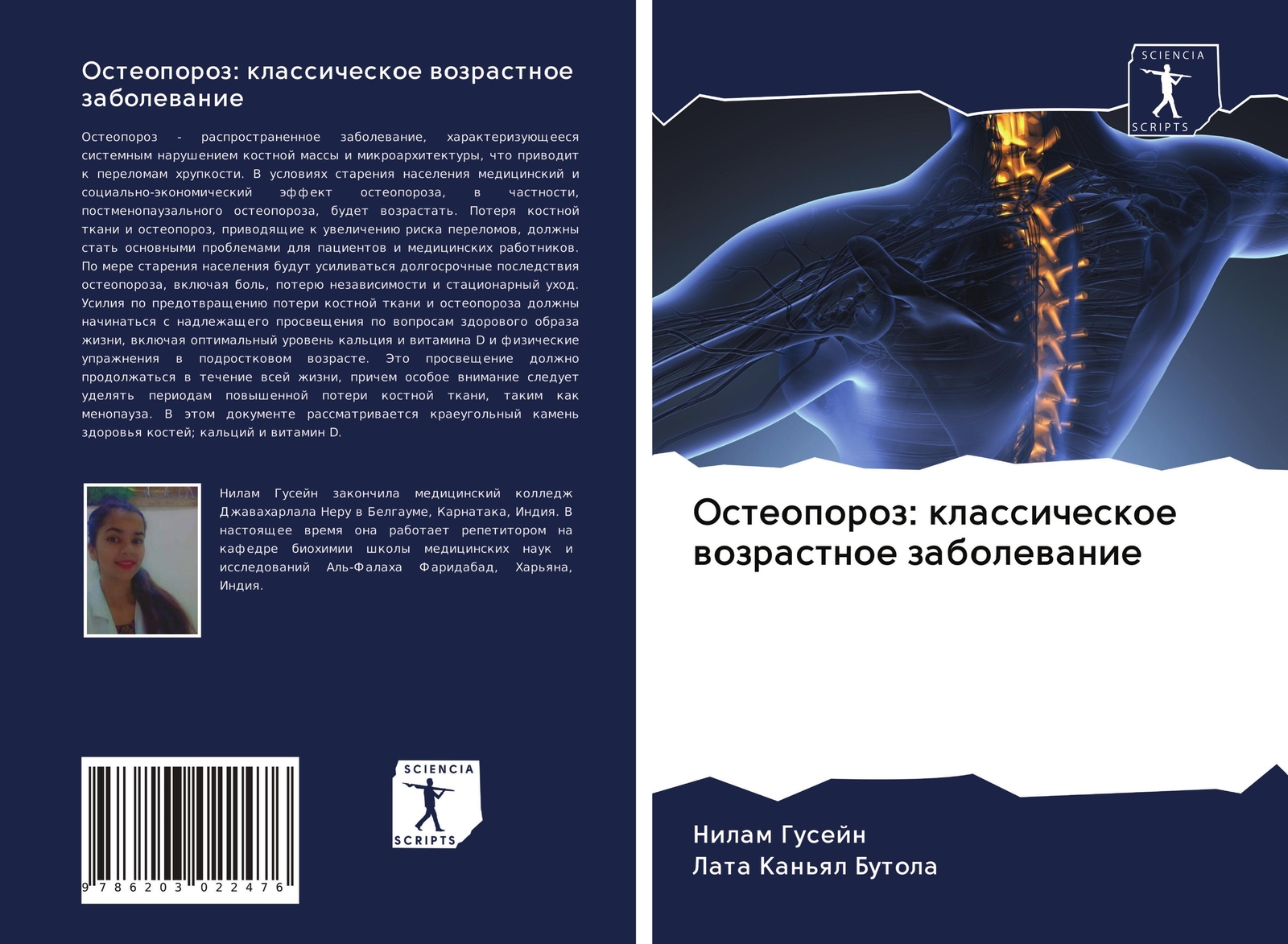 Osteoporoz: Klassicheskoe Wozrastnoe Zabolewanie Nilam Gusejn (u. A.)