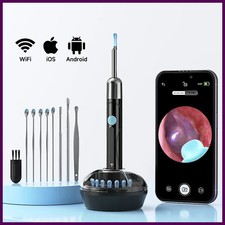 WiFi Endoscope 4.2mm 1080P Ear Camera Otoscope Ear Cleaning Tool iOS Android