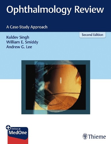 Ophthalmology Review - 9781626231764