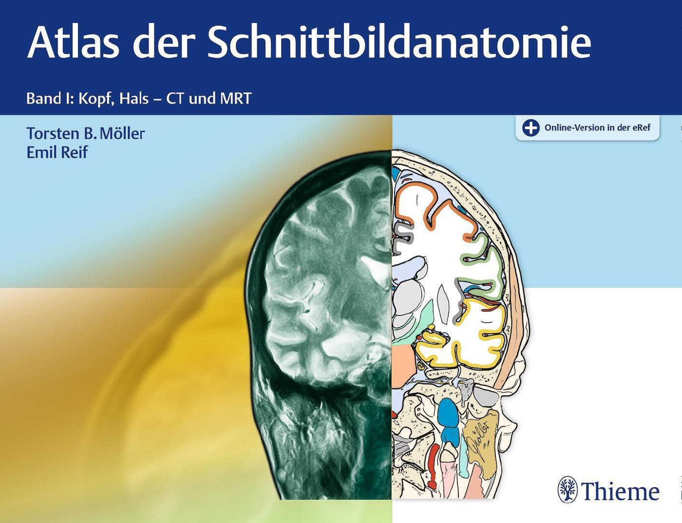 Thumbnail - Atlas Der Schnittbildanatomie. Band 01 | Band I: Kopf, Hals - Ct Und
