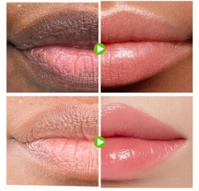 NAXR 2pcs Lip Lightening Bleaching Cream Effective Treatment Remove Dark Smoker