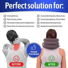 Cervical Neck Stretcher Traction Device for Chronic Neck Shoulder Alignment Pa