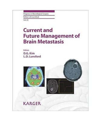 Current and Future Management of Brain Metastasis