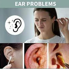 2X Antifungal Ear Drops – Effective Treatment for Ear Infections 15ml USA