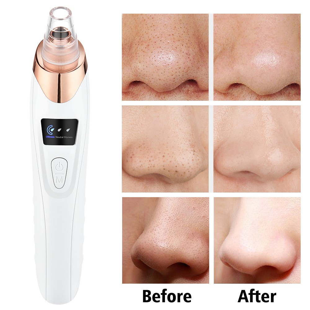 Electric Blackhead Remover Vacuum Facial Pore Cleanser Acne Skin Face Cleanser