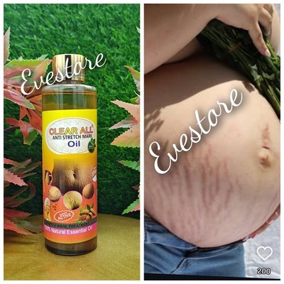 Clear ALL anti Stretch Mark Oil. Vit.E, Almond Oil, Glutathion. Super Active.x1