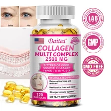 Collagen Complex: elastic skin, strong hair and nails, reduced wrinkles