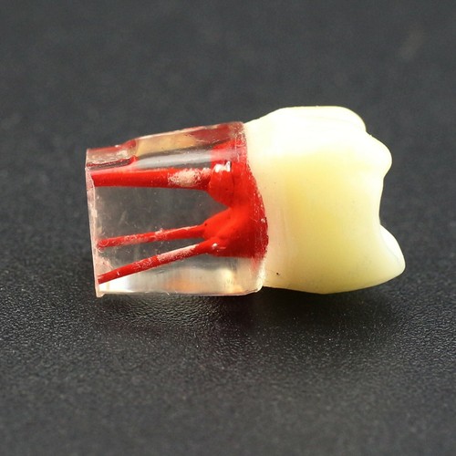 10PCS Kilgore Nissin Type Dental Root Canal Teeth Model For Endo Study Practice - Picture 57 of 80