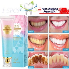 Niacinamide Whitening Toothpaste,Natural Niacinamide Toothpaste,Teeth Whitening