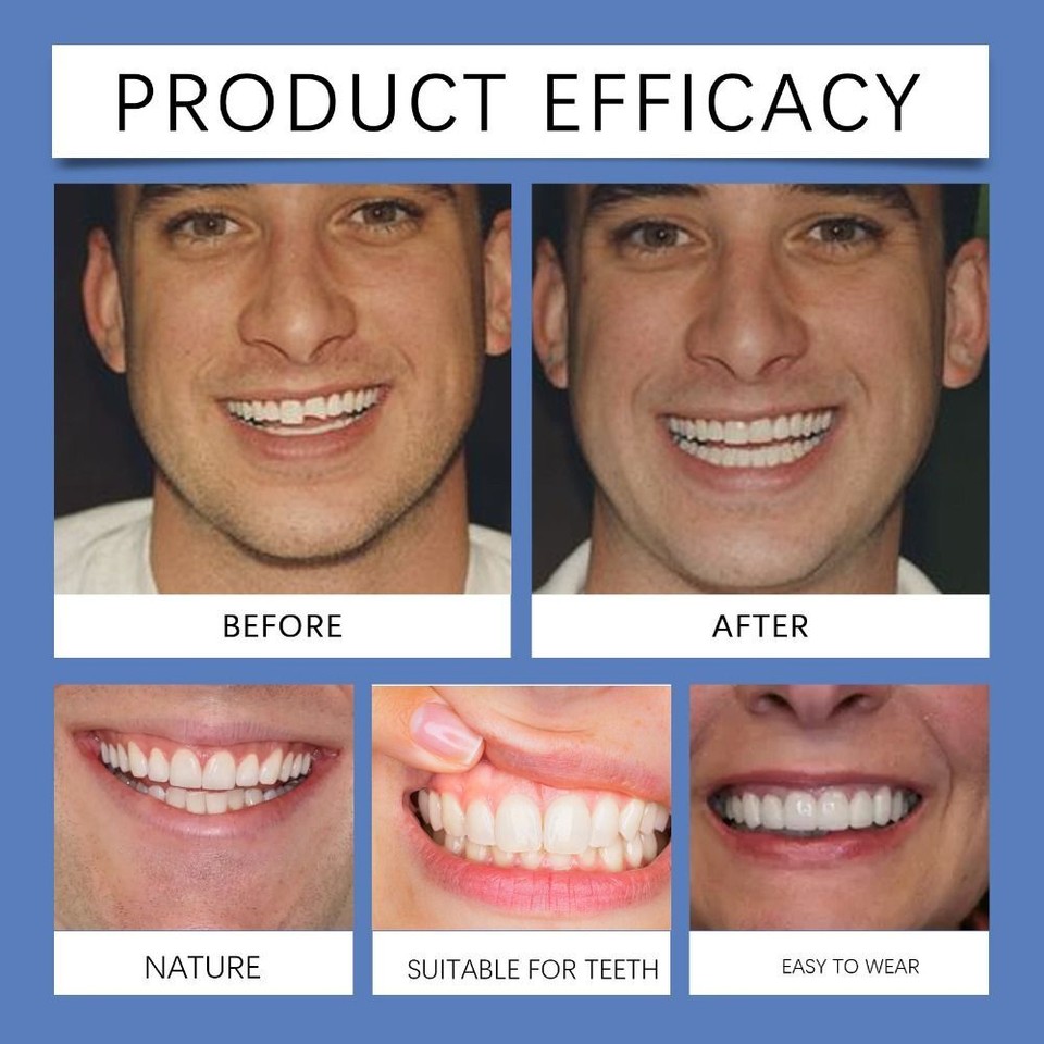 Soft Denture Reline Kit for Both Upper and Lower Denture eBay