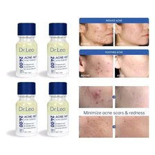 4X Dr.Leo Salicylic Acid Acne Treatment Drying Lotion Anti-Acne Blemishes 10 ml.