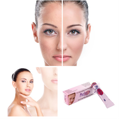 face pigmentation cream