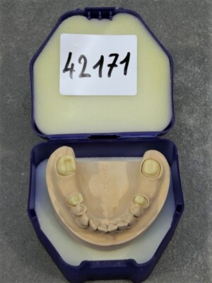 ivoclar vivadent IPS e.max mandibular model dental model model 42171