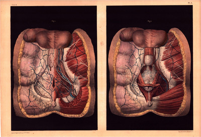 Antique Medical Print   Bourgery /Jacob Planche 5   Perineal Region 1844 Anatomy