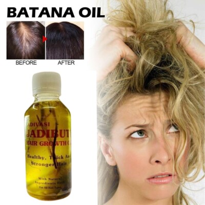 BATANA OIL FROM HONDURAS The Real One Only Come From Honduras 100ml