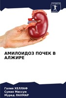 Amiloidoz Pochek V Alzhire Galiq Hellaf (U. A.) Taschenbuch Russisch 2024