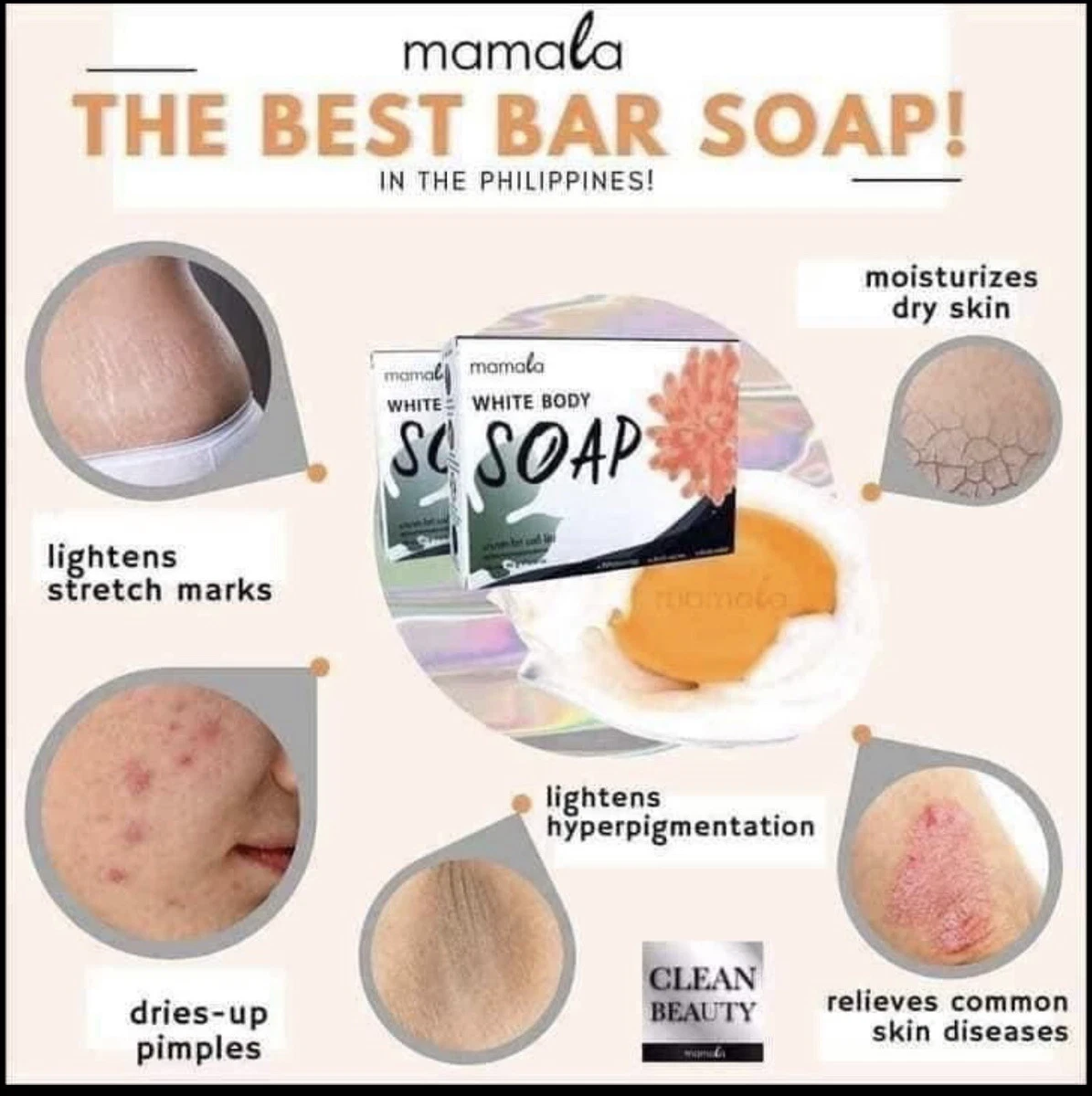 Best soap sale for pimples philippines