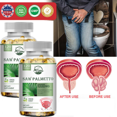 Saw Palmetto Capsules,Balance BPH Levels,Supports Urinary Tract,Prostate Health