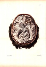 Bourgery & Jacob Brain Sections Lithographs  Plates 23 & 24, Paris 1844, w/ Text