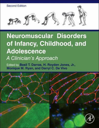 Neuromuscular Disorders of Infancy, Childhood, and Adolescence Darras Jones 2e